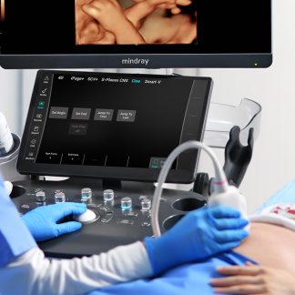 3D/4D Ultrasound