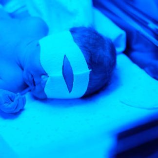 Neonate Bilirubin Phototherapy Equipment